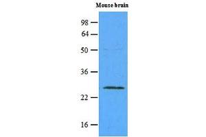Western blot analysis: The extracts of mouse brain (45ug) were resolved by SDS-PAGE, transferred to NC membrane and probed with anti-human Rab5a (1:500). (RAB5 antibody)