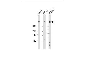 All lanes : Anti-DYNC1H1 Antibody (C-term) at 1:2000 dilution Lane 1: A431 whole cell lysate Lane 2: PC-3 whole cell lysate Lane 3: mouse brain lysate Lysates/proteins at 20 μg per lane. (DYNC1H1 antibody  (C-Term))