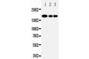 Anti-MRP1 antibody, Western blotting Lane 1: JURKAT Cell Lysate Lane 2: CEM Cell Lysate Lane 3: A549 Cell Lysate
