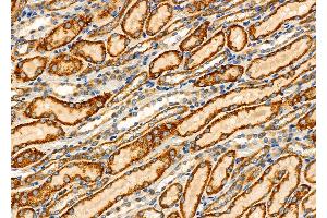ABIN6265692 and ABIN6276452 at 1/100 staining Rat kidney tissue by IHC-P. (TPMT antibody  (N-Term))
