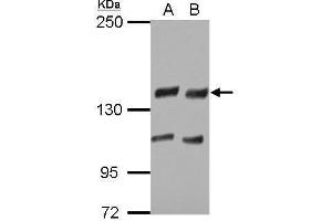 WB Image Sample (30 ug of whole cell lysate) A: H1299 B: HCT116 5% SDS PAGE antibody diluted at 1:5000