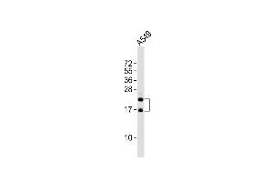 Anti-FGF2 Antibody at 1:2000 dilution + A549 whole cell lysates Lysates/proteins at 20 μg per lane. (FGF2 antibody)