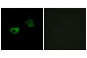 Immunofluorescence analysis of HepG2 cells, using MTR1A antibody.
