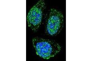 Confocal immunofluorescent analysis of IL17B with Hela cells using Interleukin-17B / IL17B  Antibody , followed by Alexa Fluor 488-conjugated goat anti-rabbit lgG (green). (IL17B antibody  (Middle Region))