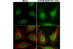 ICC/IF Image Cofilin 1 antibody detects Cofilin 1 protein at cytoplasm and nucleus by immunofluorescent analysis. (Cofilin antibody)