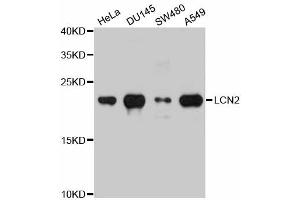 Western blot analysis of extracts of various cell lines, using LCN2 antibody (ABIN5971118) at 1/1000 dilution. (Lipocalin 2 antibody)