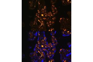 Immunofluorescence analysis of Human placenta using ApoER2/ApoER2/LRP8 antibody (ABIN6134224, ABIN6143337, ABIN6143338 and ABIN6214801) at dilution of 1:100. (LRP8 antibody  (C-Term))