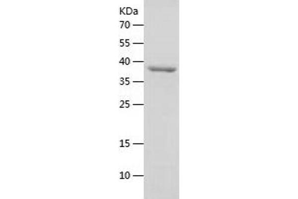 EIF2A Protein (AA 1-315) (His tag)