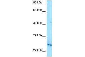 WB Suggested Anti-Cmpk1 Antibody Titration: 1. (Cytidine Monophosphate (UMP-CMP) Kinase 1, Cytosolic (CMPK1) (C-Term) antibody)