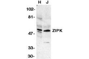 Western blot analysis of ZIP kinase in HeLa (H) and Jurkat (J) whole cell lysates with ZIAP31006PU-N at 1 μg/ml. (DAPK3 antibody  (Center))