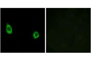 Immunofluorescence analysis of HuvEc cells, using CHST9 Antibody. (CHST9 antibody  (AA 361-410))