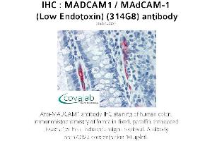 Image no. 2 for anti-Mucosal Vascular Addressin Cell Adhesion Molecule 1 (MADCAM1) antibody (ABIN5693628) (MADCAM1 antibody)