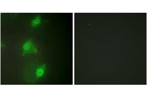 Immunofluorescence analysis of HeLa cells, using AIRE Antibody. (AIRE antibody  (AA 91-140))