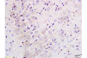 Formalin-fixed and paraffin embedded rat brain labeled with Anti-TLR1 Polyclonal Antibody, Unconjugated (ABIN736373) at 1:200 followed by conjugation to the secondary antibody and DAB staining. (TLR1 antibody  (AA 101-200))