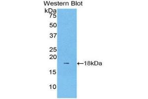 Western Blotting (WB) image for anti-Lecithin-Cholesterol Acyltransferase (LCAT) (AA 290-433) antibody (ABIN1176762) (LCAT antibody  (AA 290-433))