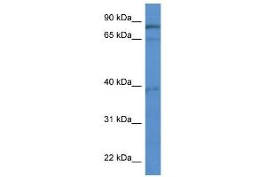 WB Suggested Anti-ZCCHC7 Antibody Titration: 0.