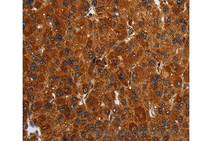 Immunohistochemistry of Human brain  using ENTPD7 Polyclonal Antibody at dilution of 1:40