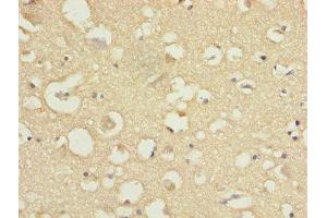 Immunohistochemistry of paraffin-embedded human brain tissue using ABIN7148022 at dilution of 1:100
