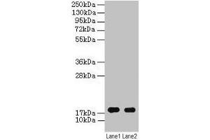 Western blot All lanes: ATP5F1D antibody at 2 μg/mL Lane 1: EC109 whole cell lysate Lane 2: 293T whole cell lysate Secondary Goat polyclonal to rabbit IgG at 1/15000 dilution Predicted band size: 18 kDa Observed band size: 18 kDa (ATP5F1D antibody  (AA 32-158))