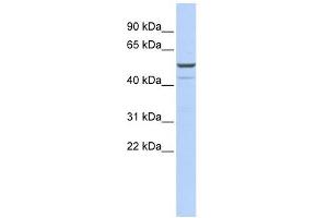 KCNK12 antibody used at 1 ug/ml to detect target protein. (KCNK12 antibody  (Middle Region))