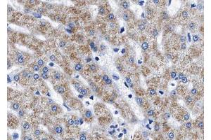 ABIN6267543 at 1/100 staining human liver tissue sections by IHC-P. (Tuberin antibody  (pThr1462))