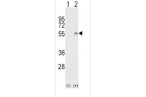 Western blot analysis of HP (arrow) using rabbit polyclonal HP Antibody (Center) (ABIN652875 and ABIN2842566). (Haptoglobin antibody  (Center))