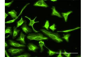 Immunofluorescence of purified MaxPab antibody to OTUB2 on HeLa cell. (OTUB2 antibody  (AA 1-234))