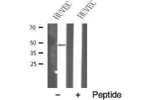 Western blot analysis of TNF Receptor II expression in HUVEC cell lysate (TNFRSF1B antibody  (C-Term))