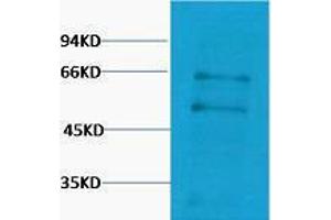 Western Blotting (WB) image for anti-Myc Proto-Oncogene protein (MYC) antibody (ABIN3181293) (c-MYC antibody)