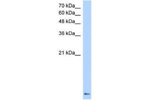 Transfected 293T; WB Suggested Anti-ZNF706 Antibody Titration: 0. (ZNF706 antibody  (N-Term))