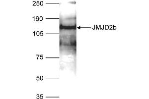 Western Blot of anti-JMJD2b antibody Western Blot results of Rabbit anti-JMJD2b antibody. (KDM4B antibody  (Internal Region))