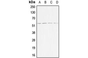 Western blot analysis of ACVR1B expression in HeLa (A), Jurkat (B), SP2/0 (C), H9C2 (D) whole cell lysates.