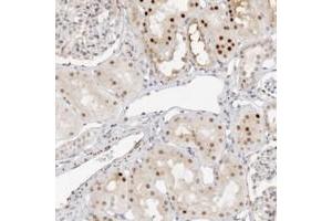 Immunohistochemical staining of human kidney with HIPK3 polyclonal antibody  shows strong nuclear positivity in cells in tubules. (HIPK3 antibody)
