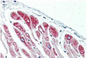 Human Heart (formalin-fixed, paraffin-embedded) stained with DES antibody ABIN396919 at 10 ug/ml followed by biotinylated anti-mouse IgG secondary antibody ABIN481714, alkaline phosphatase-streptavidin and chromogen. (Desmin antibody)