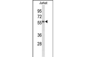 Western blot analysis of SACM1L Antibody (C-term) (ABIN653512 and ABIN2842917) in Jurkat cell line lysates (35 μg/lane). (SACM1L antibody  (C-Term))