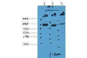 Western Blotting (WB) image for anti-Keratin 7 (KRT7) antibody (ABIN3181124) (Cytokeratin 7 antibody)