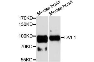 Western blot analysis of extracts of various cell lines, using DVL1 antibody. (DVL1 antibody)