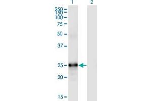 Western Blot analysis of FGF19 expression in transfected 293T cell line by FGF19 monoclonal antibody (M01), clone 4C4. (FGF19 antibody  (AA 1-216))