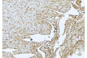 ABIN6273408 at 1/100 staining Mouse muscle tissue by IHC-P. (TNNT3 antibody  (C-Term))