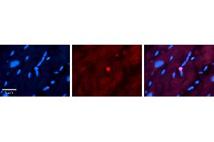 Rabbit Anti-APTX Antibody   Formalin Fixed Paraffin Embedded Tissue: Human heart Tissue Observed Staining: Nucleus Primary Antibody Concentration: 1:100 Other Working Concentrations: N/A Secondary Antibody: Donkey anti-Rabbit-Cy3 Secondary Antibody Concentration: 1:200 Magnification: 20X Exposure Time: 0. (Aprataxin antibody  (N-Term))