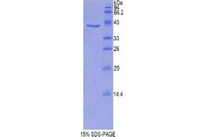 SDS-PAGE analysis of Mouse Profilin 1 Protein. (PFN1 Protein)