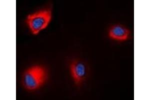 Immunofluorescent analysis of ANAPC1 (pS688) staining in HEK293T cells. (APC1 antibody  (pSer688))