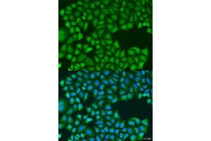 Immunofluorescence analysis of U2OS cells using TIRAP antibody.