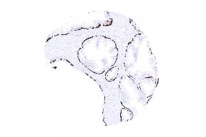 Strong KRT14 positivity in basal cells of the prostate (Recombinant KRT14 antibody  (AA 350-472))