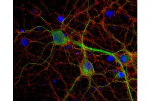 Indirect immunostaining of PFA fixed rat hippocampus neurons with anti-Munc18-1, (dilution 1 : 500; red) and mouse anti-MAP 2 (cat. (STXBP1 antibody)