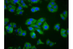 CTAGE1 antibody  (AA 471-595)