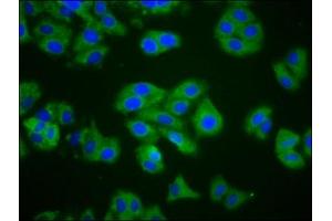 Immunofluorescence staining of HepG2 cells with ABIN7148706 at 1:200, counter-stained with DAPI. (CTAGE1 antibody  (AA 471-595))