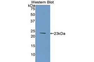 Western blot analysis of the recombinant protein. (COL6A1 antibody  (AA 828-1022))