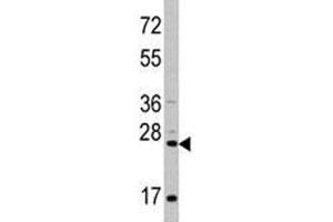 Western Blotting (WB) image for anti-CD8a Molecule (CD8A) (AA 59-88) antibody (ABIN3028555)