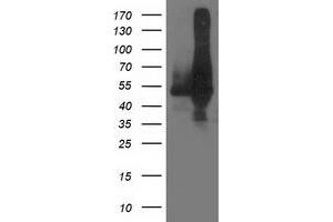 HEK293T cells were transfected with the pCMV6-ENTRY control (Left lane) or pCMV6-ENTRY DLD (Right lane) cDNA for 48 hrs and lysed. (DLD antibody)